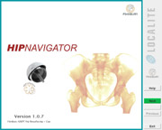 Orthopädie Hüftnavigation